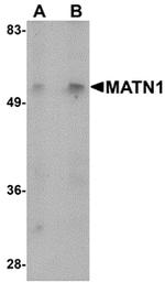 MATN1 Polyclonal Antibody