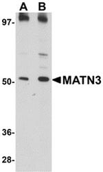 MATN3 Antibody in Western Blot (WB)