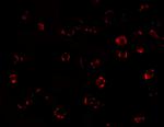 MATN3 Antibody in Immunocytochemistry (ICC/IF)