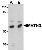 MATN3 Antibody in Western Blot (WB)