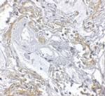 TNFAIP3 Antibody in Immunohistochemistry (IHC)