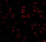 FKBP15 Antibody in Immunohistochemistry (IHC)