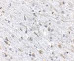 FKBP15 Antibody in Immunohistochemistry (IHC)