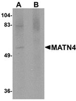MATN4 Antibody in Western Blot (WB)