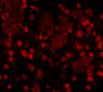 FTO Polyclonal Antibody