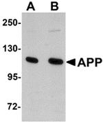 Amyloid Precursor Protein Antibody in Western Blot (WB)