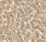 ErbB2 (HER-2) Polyclonal Antibody