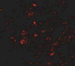 Transthyretin Antibody in Immunohistochemistry (IHC)