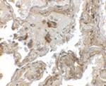 Transthyretin Polyclonal Antibody