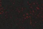LDLR Antibody in Immunohistochemistry (IHC)