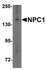 NPC1 Antibody in Western Blot (WB)