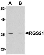 RGS21 Antibody in Western Blot (WB)