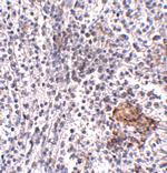 SHOC2 Polyclonal Antibody