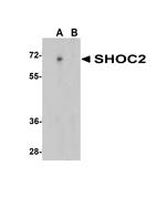 SHOC2 Antibody in Western Blot (WB)