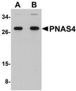 PNAS4 Polyclonal Antibody