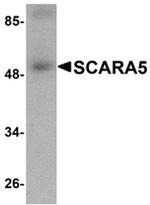SCARA5 Antibody in Western Blot (WB)