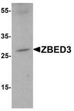 ZBED3 Polyclonal Antibody