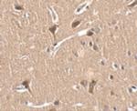 ZNF667 Polyclonal Antibody