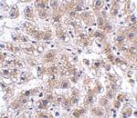 AFAP1L2 Polyclonal Antibody