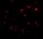 KLHL15 Antibody in Immunocytochemistry (ICC/IF)