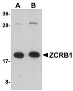 ZCRB1 Polyclonal Antibody