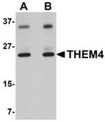 THEM4 Antibody in Western Blot (WB)
