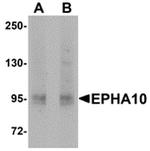 EphA10 Polyclonal Antibody