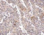 SYPL2 Antibody in Immunohistochemistry (IHC)