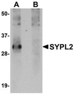 SYPL2 Antibody in Western Blot (WB)