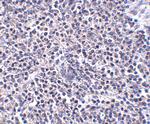 ARL15 Polyclonal Antibody