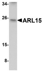 ARL15 Antibody in Western Blot (WB)