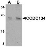 CCDC134 Antibody in Western Blot (WB)
