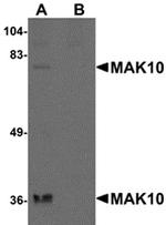 MAK10 Antibody in Western Blot (WB)