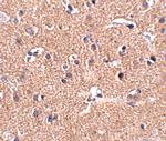 GALNT10 Polyclonal Antibody