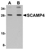 SCAMP4 Antibody in Western Blot (WB)