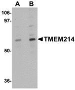 TMEM214 Antibody in Western Blot (WB)