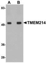 TMEM214 Polyclonal Antibody