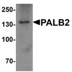 PALB2 Polyclonal Antibody