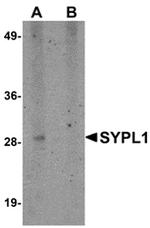 SYPL1 Polyclonal Antibody