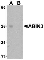 TNIP3 Antibody in Western Blot (WB)