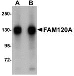 FAM120A Antibody in Western Blot (WB)