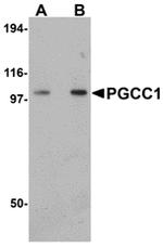 FAM120B Polyclonal Antibody