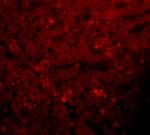 JMJD1A Polyclonal Antibody