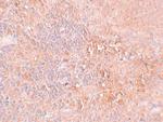 JMJD4 Polyclonal Antibody