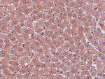 JMJD2A Polyclonal Antibody