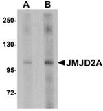 JMJD2A Antibody in Western Blot (WB)