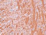 JMJD6 Polyclonal Antibody