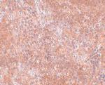 JMJD8 Antibody in Immunohistochemistry (IHC)