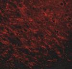 Prosapip1 Antibody in Immunohistochemistry (IHC)