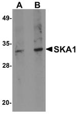 SKA1 Polyclonal Antibody